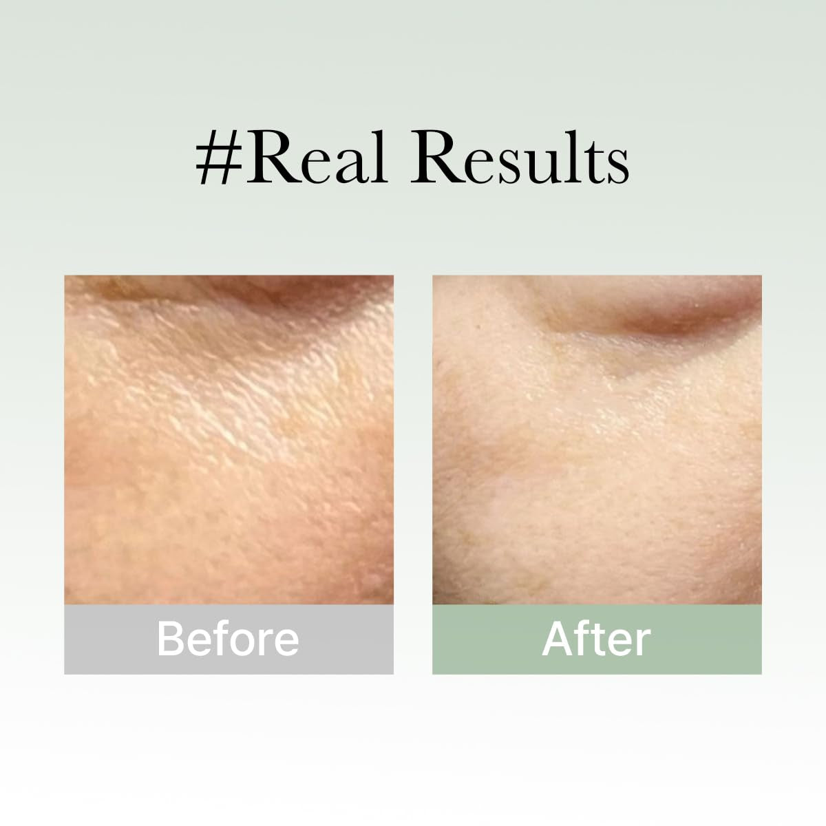 Glow Hyssop Overnight Face Mask Serum - Hydrating and Anti-Aging Formula for Youthful Korean Glass Skin with 30% Vitamins A, C, E and 10% Niacinamide and Peptides